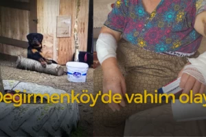 Köpeklerin saldırısına uğrayan kadın hastanelik oldu